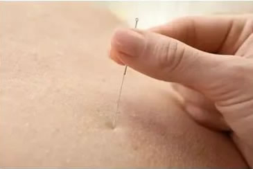 [我为群众办实事]妇女保健科开展“三八妇女节”义诊义检活动